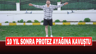 On Sene Sonra Yürümenin Mutluluğunu Yaşıyor: Uçak Bombasıyla Kaybettiği Bacağına Protezle Kavuştu