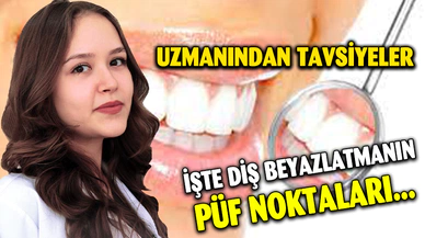 DİŞ BEYAZLATMANIN PÜF NOKTALARI