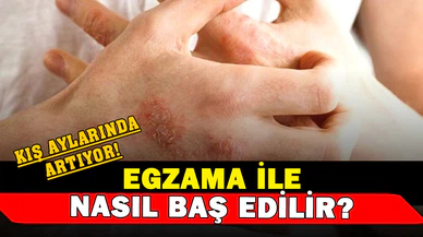 Egzama ile Nasıl Başa Çıkılır?
