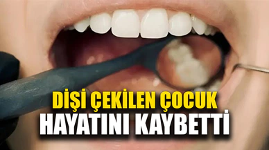 10 yaşındaki çocuk diş çekimi sonrası hayatını kaybetti