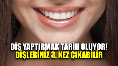 Diş yaptırmak tarih oluyor artık dişleriniz 3. kez çıkabilir