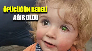 Bir öpücük küçük Juwan'ın hayatını kararttı