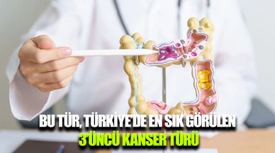 Kolon kanserinde erken teşhis hayat kurtarıyor