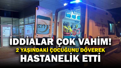 2 yaşındaki çocuğunu döverek hastanelik etti, tutuklandı