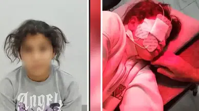 Diş tedavisi hayatını kararttı! Aile 10 aydır çözüm arıyor