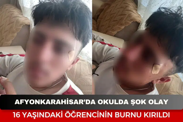 Afyonkarahisar’da okulda şok olay: 16 yaşındaki öğrencinin burnu kırıldı